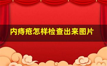 内痔疮怎样检查出来图片