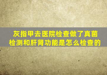 灰指甲去医院检查做了真菌检测和肝肾功能是怎么检查的