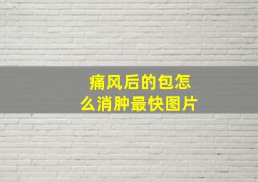 痛风后的包怎么消肿最快图片