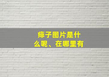 痱子图片是什么呢、在哪里有