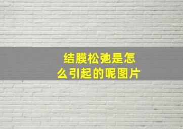 结膜松弛是怎么引起的呢图片