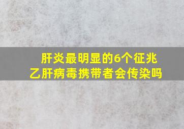 肝炎最明显的6个征兆乙肝病毒携带者会传染吗