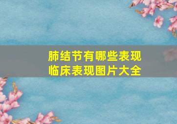 肺结节有哪些表现临床表现图片大全