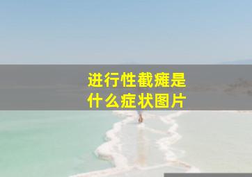 进行性截瘫是什么症状图片